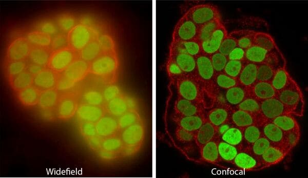 confocal image